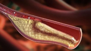 kycom-快捷美食推荐四道：芦笋，青菜，春笋，花菜的做法(图1)