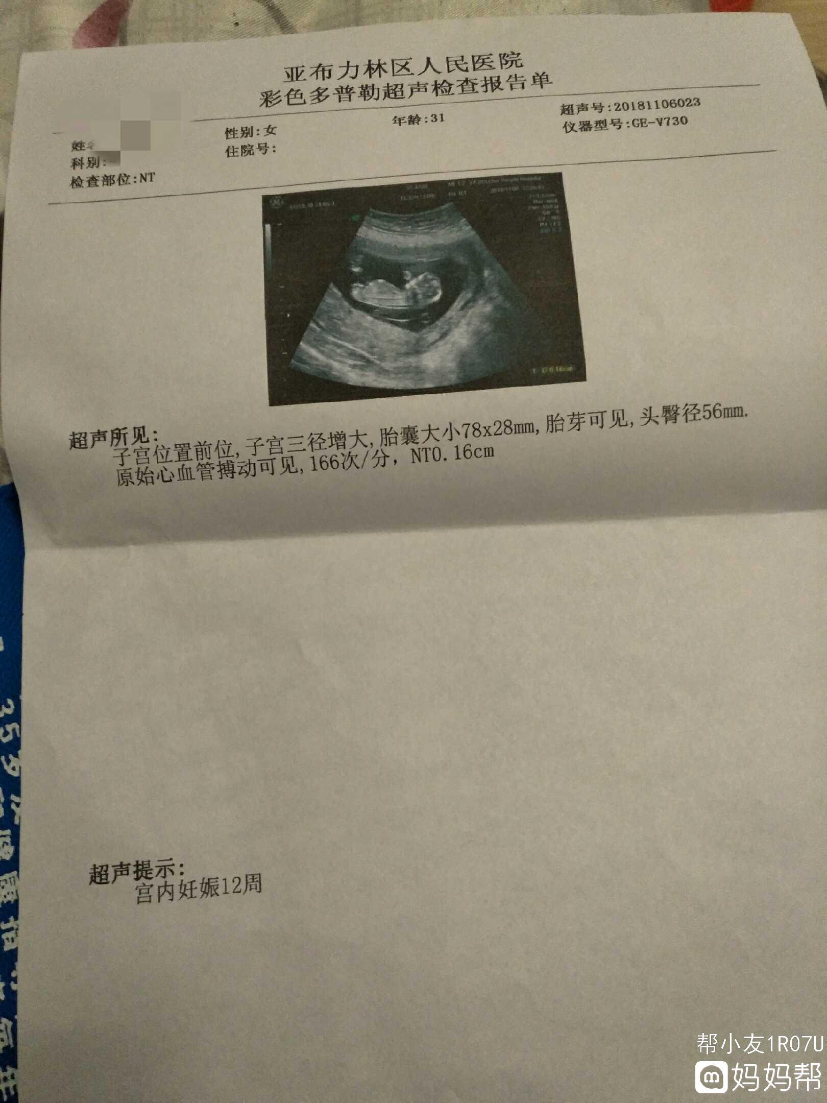 家装中,这些常用尺寸一定要记住!省钱就靠它了!“kycom”(图1) 家装中,这些常用尺寸一定要记住!省钱就靠它了!“kycom”(图1)